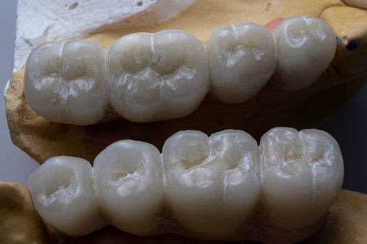 Periodontal Pockets