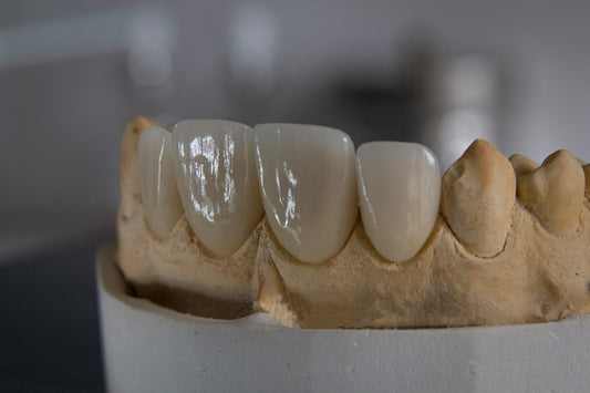 Crowns, Bridges & Veneers