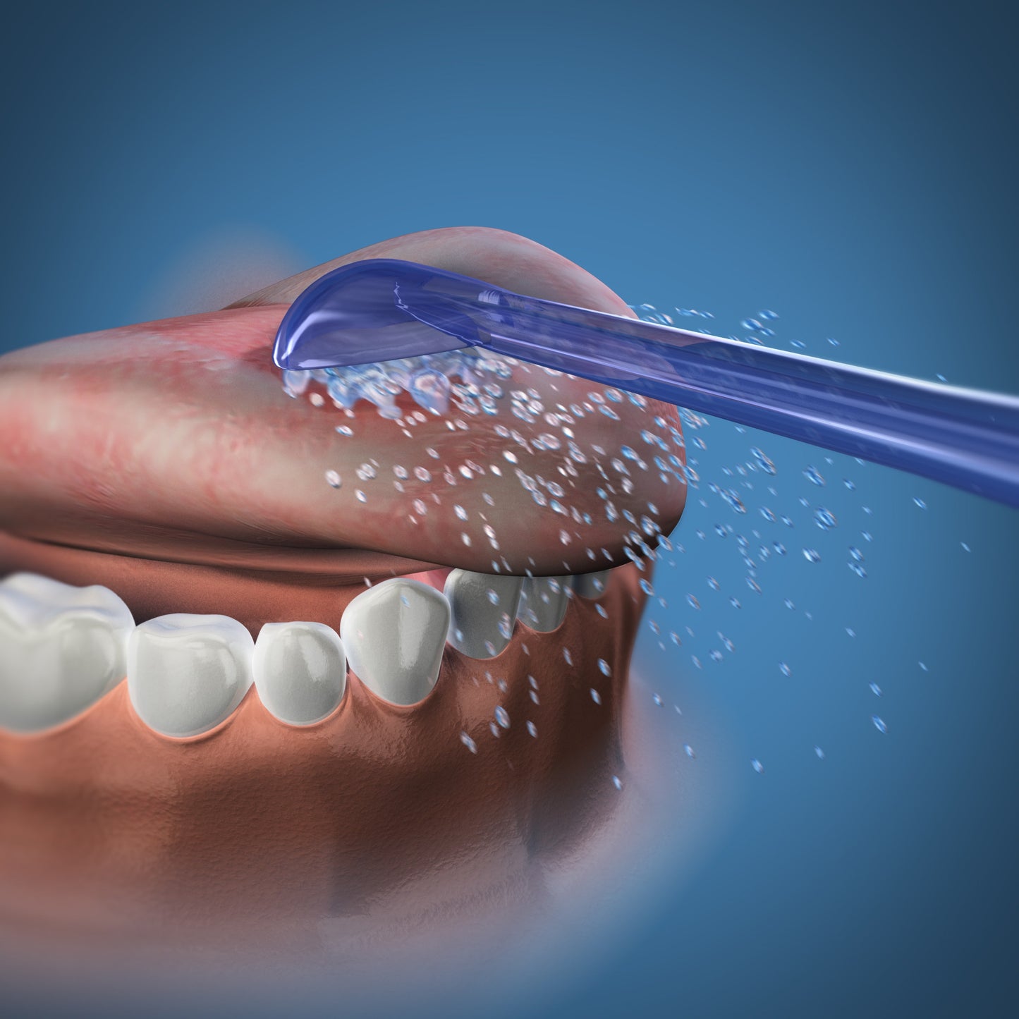 Using TC-100E Tongue Cleaner Tips