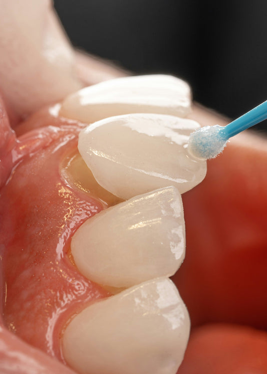 Crowns, Bridges & Veneers