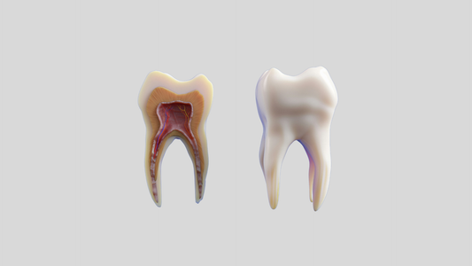 Gingivitis