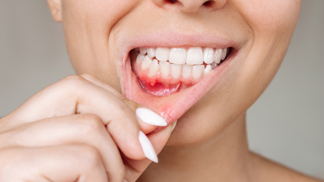 What Causes Gum Disease & How to Avoid It