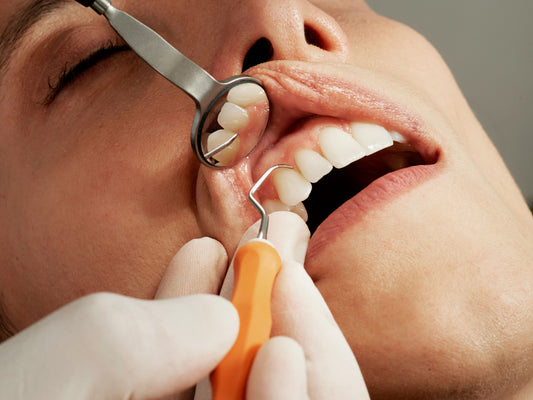 Periodontal Gum Disese