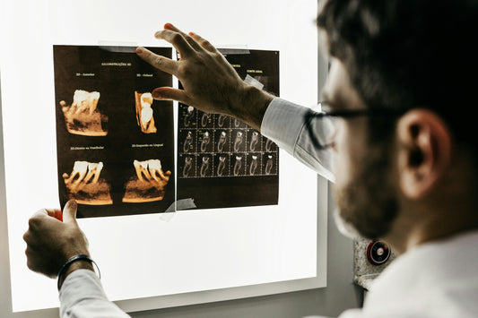 Periodontal Pockets