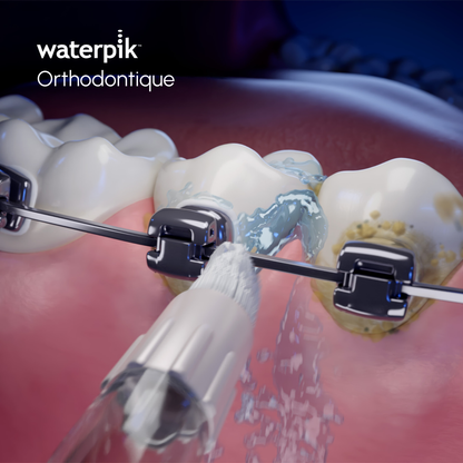 Orthodontic tip