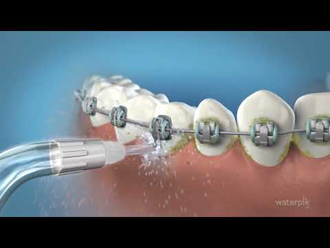 Orthodontic tip