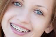 Teenager smiling with braces on teeth